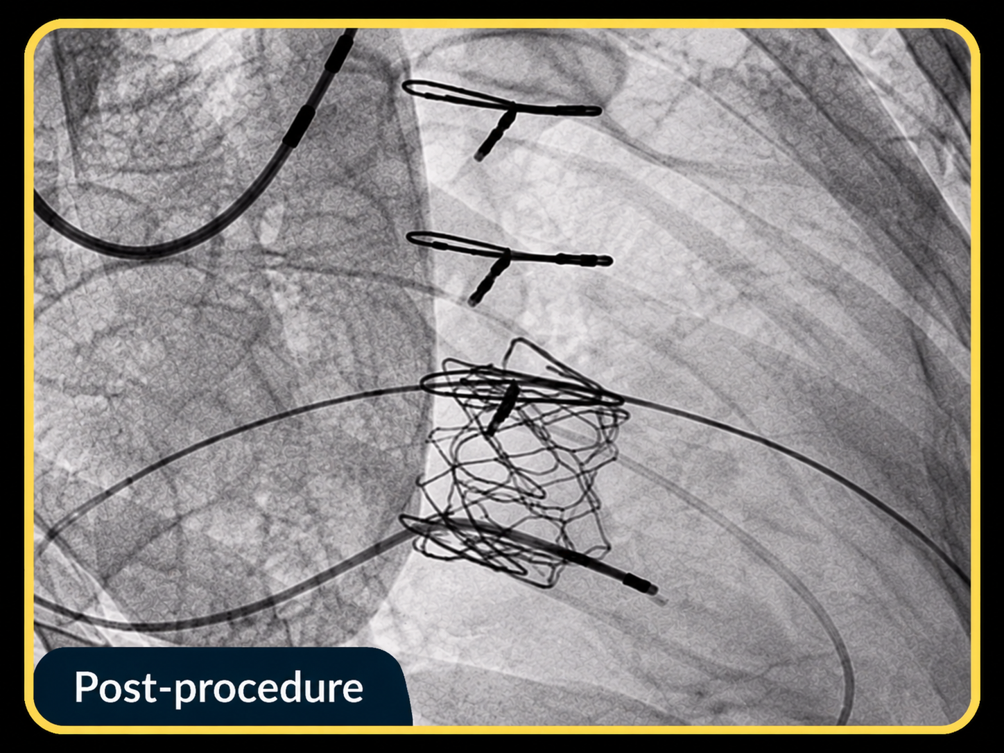 Final Deployment and Complete Leaflet Function